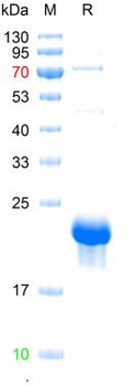 Recombinant human Adenosine Receptor A3 protein, N-Sumo