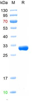 Recombinant human ACAN protein, N-His