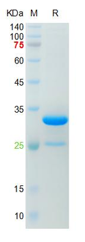 Recombinant human GLUT1 protein, GST & His