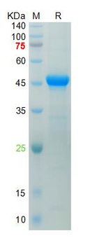Recombinant human PLA2G7 protein, His