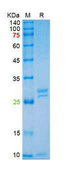 Recombinant Serratia marcescens Nuclease, His