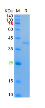 Recombinant human TLR7 protein, His