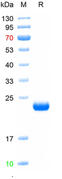 Recombinant human LHCGR protein, N-his