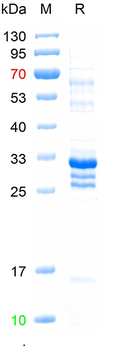 Recombinant human Podocin, N-his