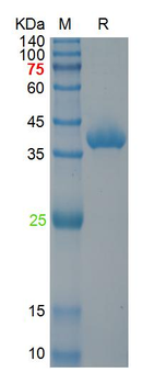 Recombinant HAdV-5 | E1A protein, N-His