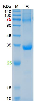 Recombinant human NALP3 protein, His