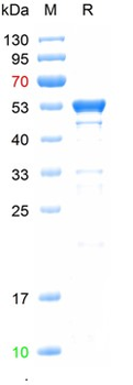 Recombinant HCoV-229E N protein, His