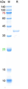 Recombinant human Pepsinogen C / PGC protein, His