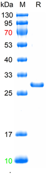Recombinant human RBP4 protein, His