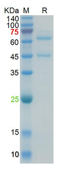 Recombinant human NFL protein, C-His