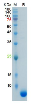 Recombinant human S100B protein, N-His