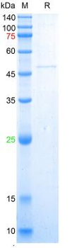 Recombinant human AD7c-NTP protein, GST