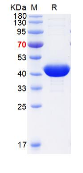Recombinant human Creatine Kinase MM protein
