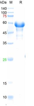 Recombinant human PEDF protein, His