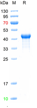 Recombinded human Cyclin D1 protein, N-His