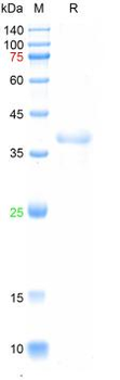 Recombinant JSRV-ENV protein, His