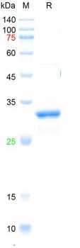 Recombinant mouse MMP-3 protein, His