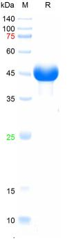 Recombinant FMDV VP1 (type O) protein, Sumo & His