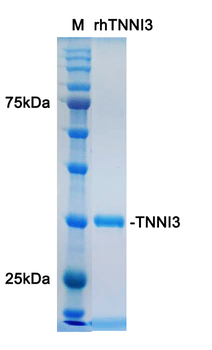 Recombinant human TNNI3 protein, His