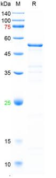 Recombinant human Tubulin Beta-5 protein, C-His