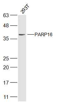 PARP16 Rabbit Polyclonal Antibody