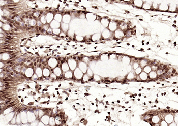 IGF2BP1 Rabbit Polyclonal Antibody
