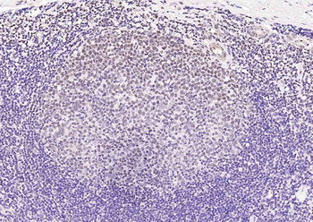 IGF2BP1 Rabbit Polyclonal Antibody