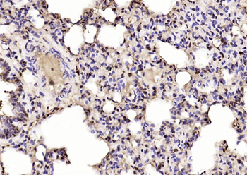 IGF2BP1 Rabbit Polyclonal Antibody