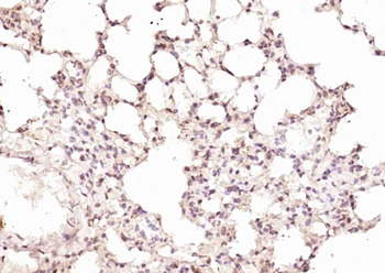 RPUSD2 Rabbit Polyclonal Antibody