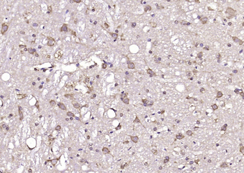 GNAI2/G protein alpha inhibitor 1 Rabbit Polyclonal Antibody