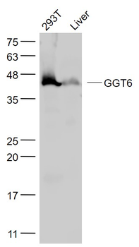 GGT6 Rabbit Polyclonal Antibody