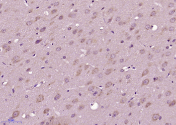 RNF61/MKRN1 Rabbit Polyclonal Antibody