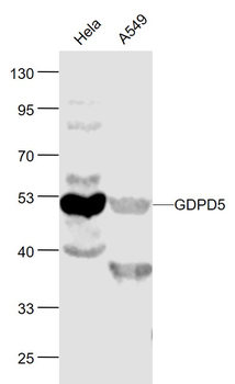 GDPD5 Rabbit Polyclonal Antibody