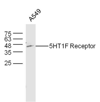 5HT1F Receptor Rabbit Polyclonal Antibody