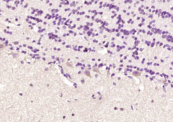 5HT5A receptor Rabbit Polyclonal Antibody