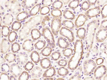 A2LD1 Rabbit Polyclonal Antibody