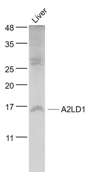 A2LD1 Rabbit Polyclonal Antibody