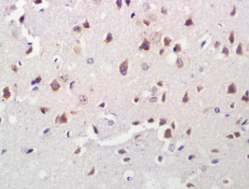 A2LD1 Rabbit Polyclonal Antibody
