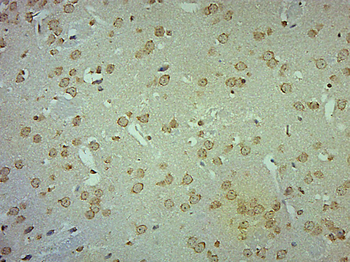 AADAC Rabbit Polyclonal Antibody