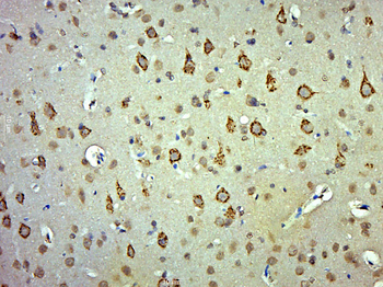 AADAC Rabbit Polyclonal Antibody