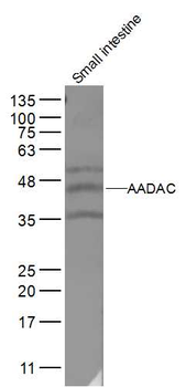 AADAC Rabbit Polyclonal Antibody
