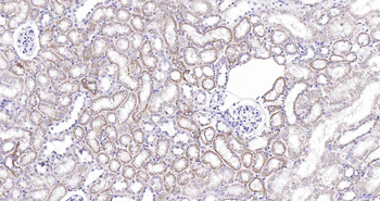 AAMP Rabbit Polyclonal Antibody