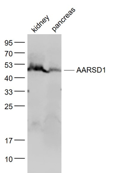 AARSD1 Rabbit Polyclonal Antibody