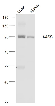 AASS Rabbit Polyclonal Antibody