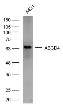 ABCD4 Rabbit Polyclonal Antibody