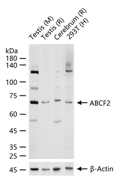 ABCF2 Rabbit Polyclonal Antibody