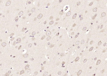 ABCF2 Rabbit Polyclonal Antibody