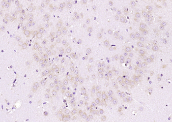 ABH1 Rabbit Polyclonal Antibody