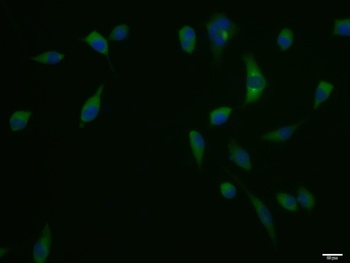 Acetyl Coenzyme A Carboxylase alpha (Phospho-Ser12 antibody)