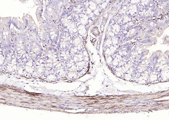 Alpha smooth muscle Actin Rabbit Polyclonal Antibody